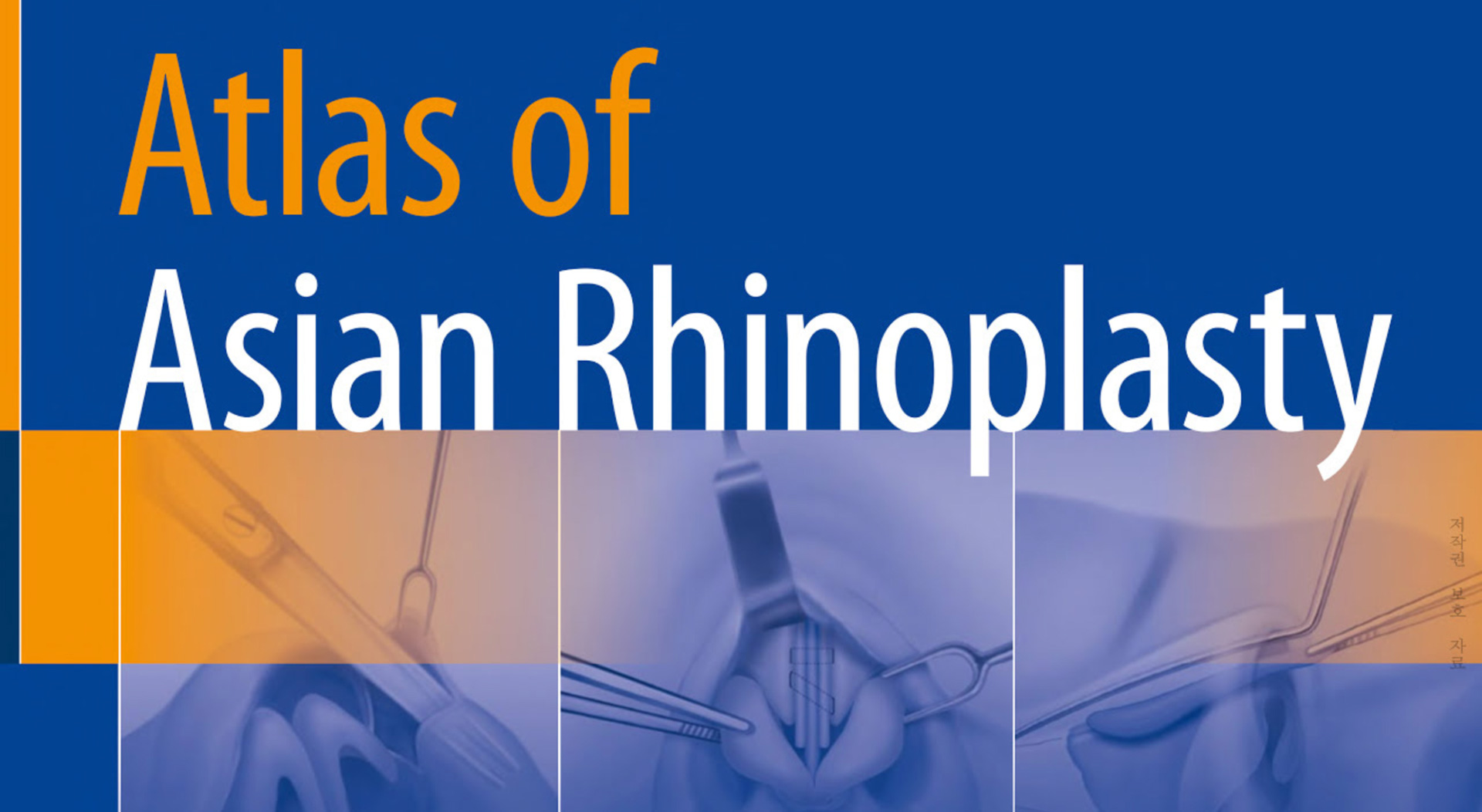 健康・医学 atlas of asian rhinoplasty Atlas of Asian Rhinoplasty: 9789811086441: Medicine & Health