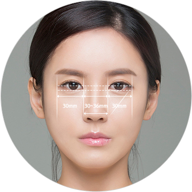 Canthoplasty-2