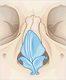 Corrective-rhinoplasty-for-deviated-nose-correction