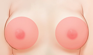 breast4_img1a