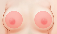 breast4_img1h