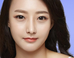 V Line Surgery In Korea (Jaw Surgery)